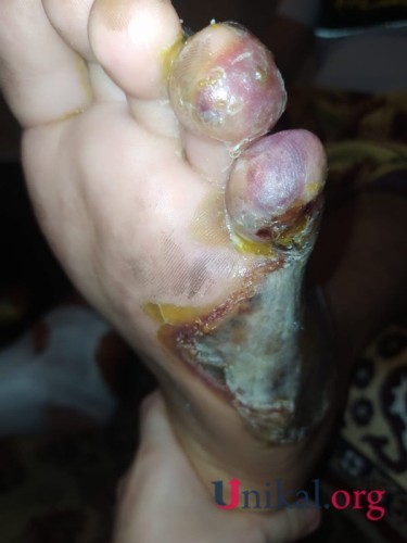 "HB Güvən" klinikasının professoru qazinin ayağını görün nə hala saldı- FOTOLAR