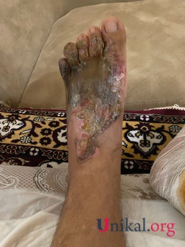 "HB Güvən" klinikasının professoru qazinin ayağını görün nə hala saldı- FOTOLAR