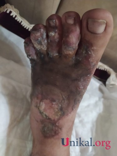 "HB Güvən" klinikasının professoru qazinin ayağını görün nə hala saldı- FOTOLAR