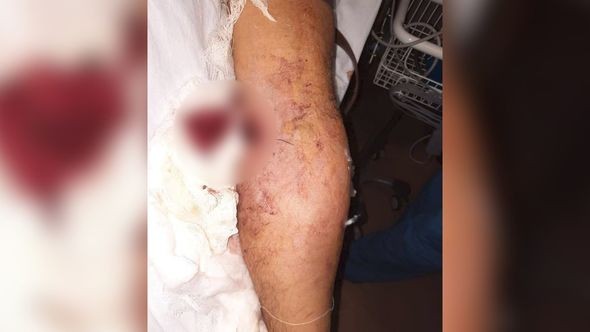 Ermənilərin yaraladığı şəxslə bağlıRƏSMİ AÇIQLAMA - YENİLƏNİB (FOTOLAR)