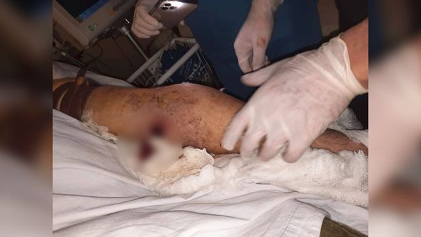 Ermənilərin yaraladığı şəxslə bağlıRƏSMİ AÇIQLAMA - YENİLƏNİB (FOTOLAR)