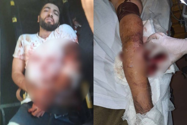 Ermənilərin yaraladığı şəxslə bağlıRƏSMİ AÇIQLAMA - YENİLƏNİB (FOTOLAR)