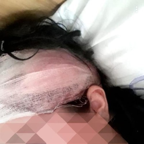 15 yaşında ərə verilən qız həyat yoldaşı və qayınanası tərəfindəndöyülürmüş - FOTO