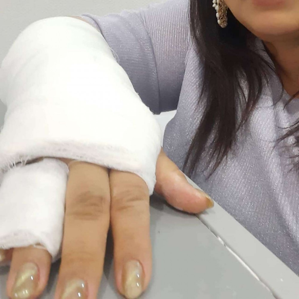 Azərbaycanlı aparıcının biləyi qırıldı -FOTOLAR