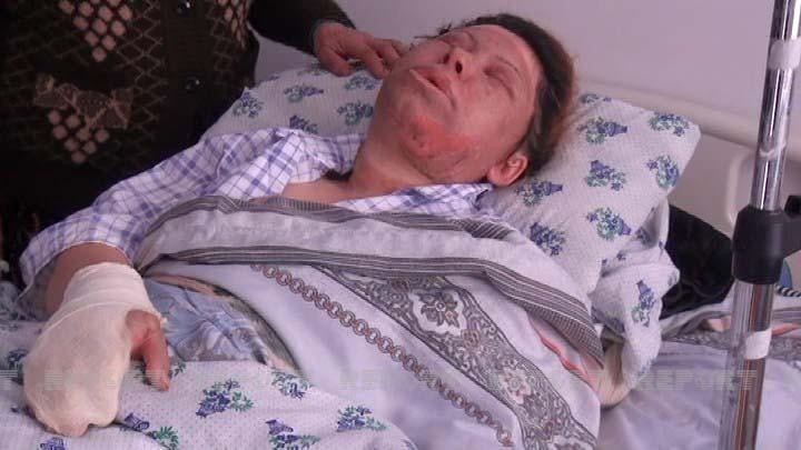 Salyanda partlayış zamanı xəsarət alanların son durumuaçıqlandı - FOTO