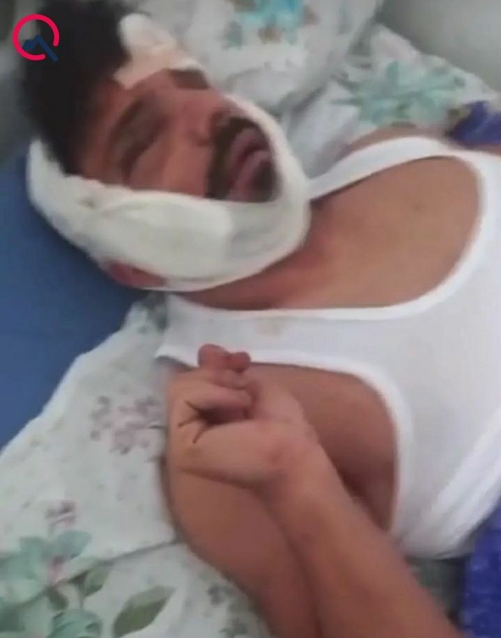 Partlayışda ağır yaralanan çempionun son halı -FOTO