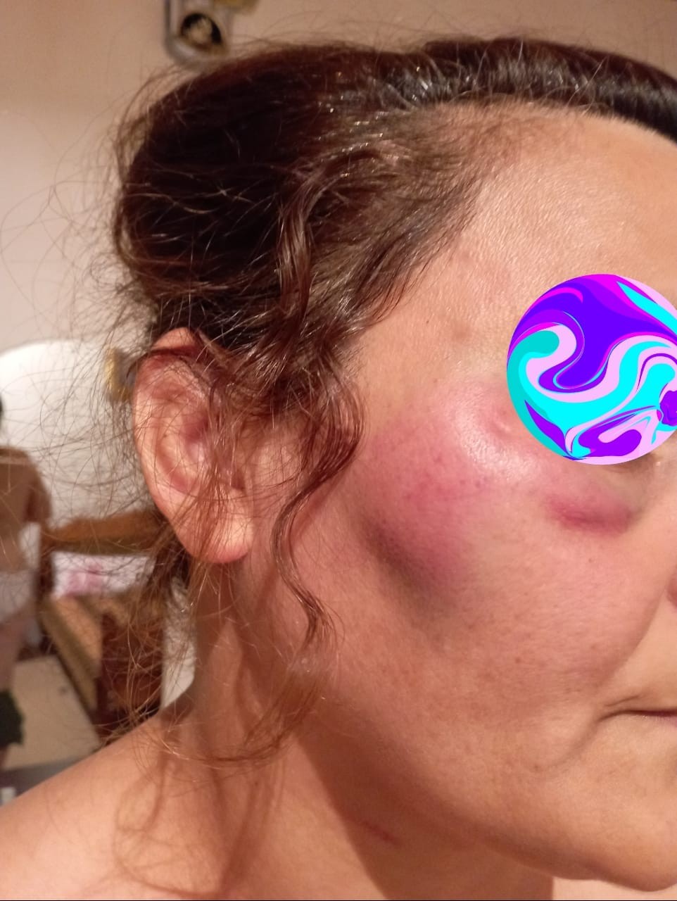 Azərbaycanda iki qadını döyüb evdən qovdular- FOTOLAR