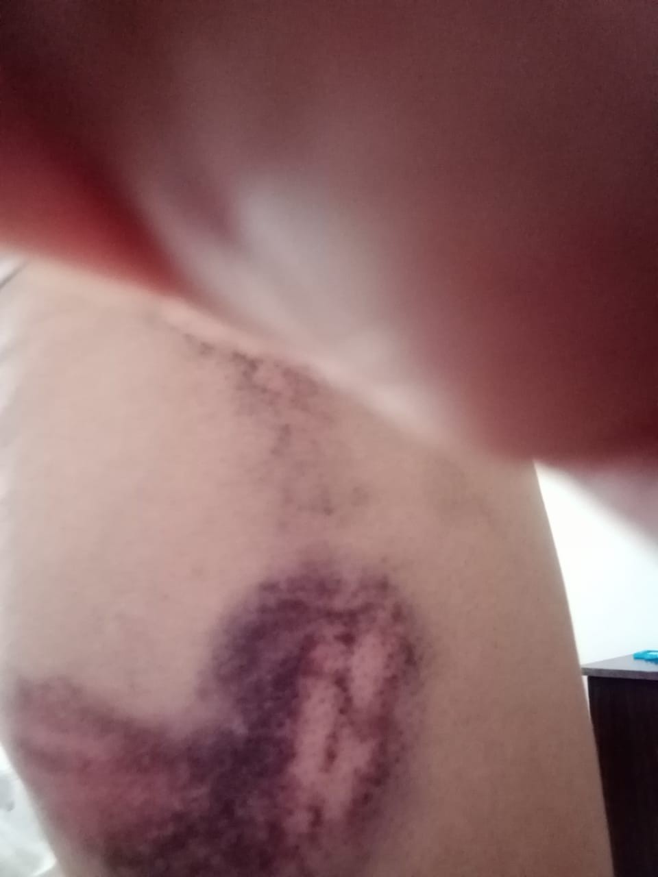 Azərbaycanda iki qadını döyüb evdən qovdular- FOTOLAR