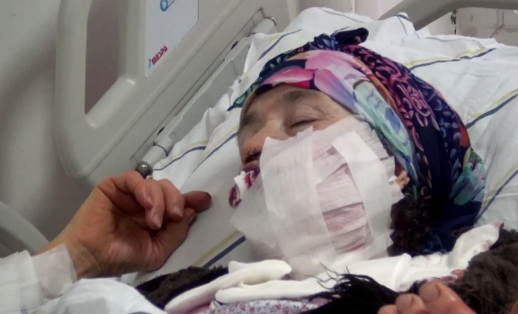 Canavar sakinlərə hücum etdi:Dörd nəfər yaralandı