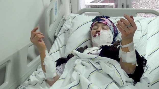 Canavar sakinlərə hücum etdi:Dörd nəfər yaralandı