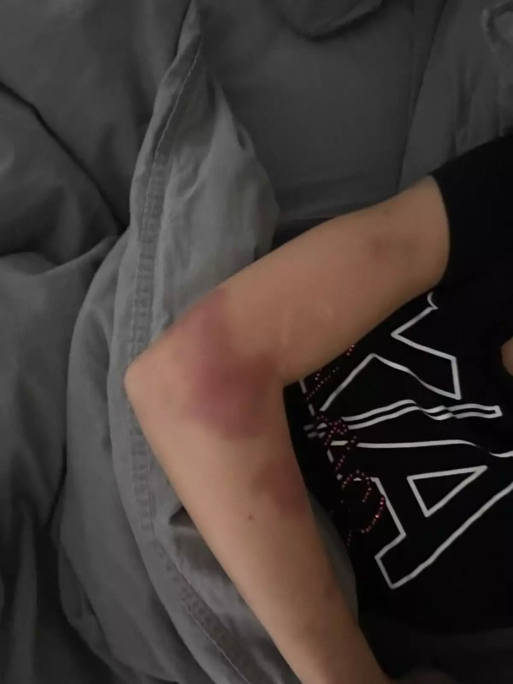 Razini döyənZiya Hüseynzadə cəzalandırıldı