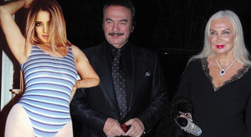 Məşhur müğənninin 79 yaşlı həyat yoldaşıplastik əməliyyat olunub? (FOTO)