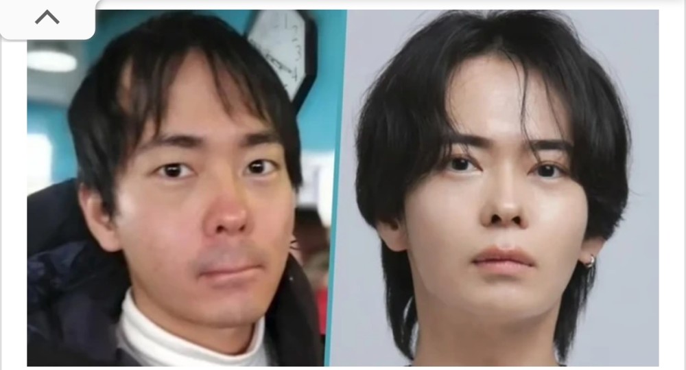 Yaponiyada kişi 10 ilə cavanlaşdı: sosial şəbəkələrdə gündəm oldu