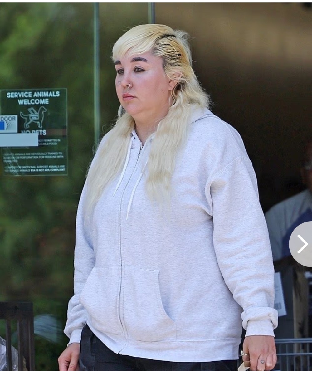 Aktrisa uzun fasilədən sonra ilk dəfə  görüntüləndi - Görün nə halda