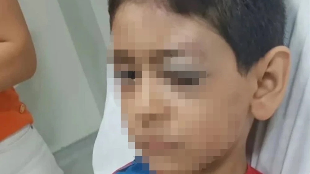 Polis məmuru oğlu ilə mübahisə edən uşağı xəstəxanalıq etdi- Türkiyədə