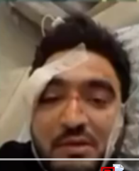 Azərbaycanlı müğənni qəzaya düşdü - üzü tanınmazhaldadır - FOTO